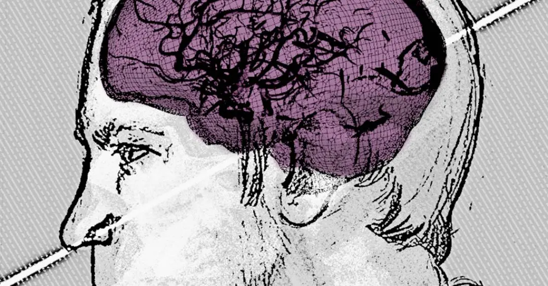 Reconstrução digital mostra como feixe de prótons atravessou cérebro de físico soviético