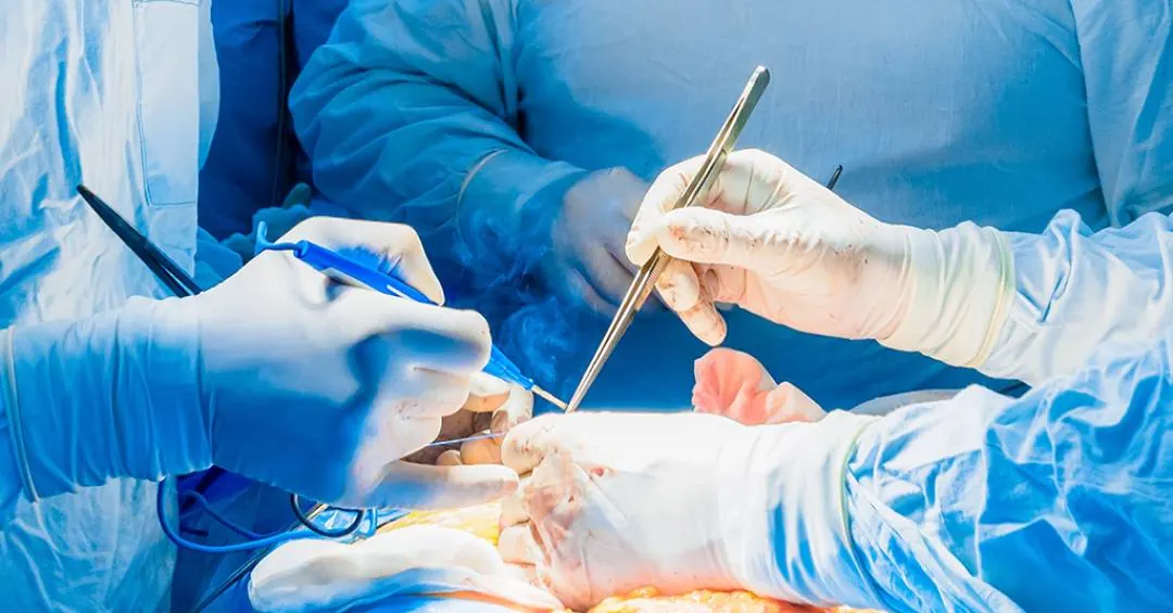 Sem robôs nem altos custos: técnica brasileira inova cirurgia do câncer de próstata no SUS